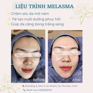 Trẻ Hóa Da
