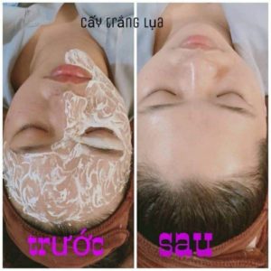 Cấy Trắng