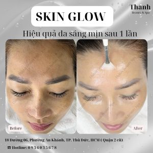 Chăm Sóc Da Chuyên Sâu Với Dịch Vụ #SkinGlow