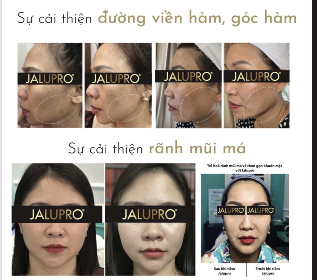Chăm Sóc Da Lão Hóa: Khám Phá Bí Quyết Giữ Gìn Tuổi Thanh Xuân Tại Thanh Beauty & Spa