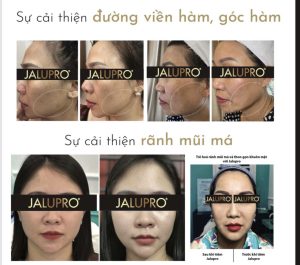 Chăm Sóc Da Lão Hóa: Khám Phá Bí Quyết Giữ Gìn Tuổi Thanh Xuân Tại Thanh Beauty & Spa