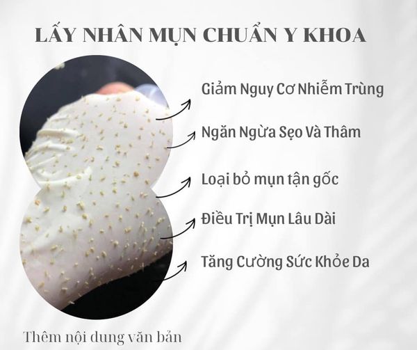 ĐAU ĐẦU VÌ HỆ LỤY CỦA MỤN-SẸO VÀ THÂM