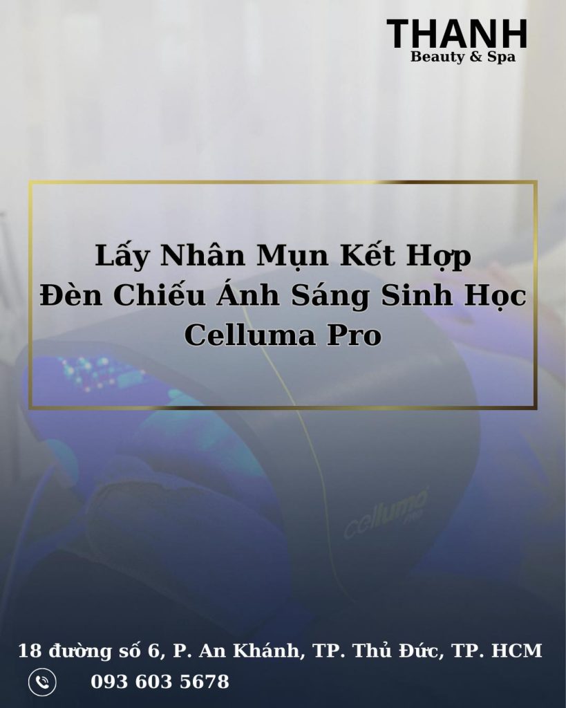 Lấy Nhân Mụn Hiệu Quả Với Ánh Sáng Sinh Học Celluma Pro Tại Thanh Beauty & Spa