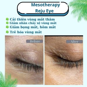 NGĂN NGỪA LÃO HÓA: CÁCH CHĂM SÓC DA VÙNG MẮT HIỆU QUẢ
