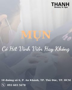Tại Sao Trị Mụn Xong Mà Mụn Vẫn Tái Phát? Cách Để Ngăn Ngừa Mụn Quay Lại!