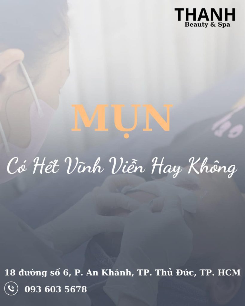 Tại Sao Trị Mụn Xong Mà Mụn Vẫn Tái Phát? Cách Để Ngăn Ngừa Mụn Quay Lại!
