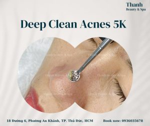 Tạm Biệt Mụn, Đón Chào Làn Da Mịn Màng tại Thanh Beauty & Spa