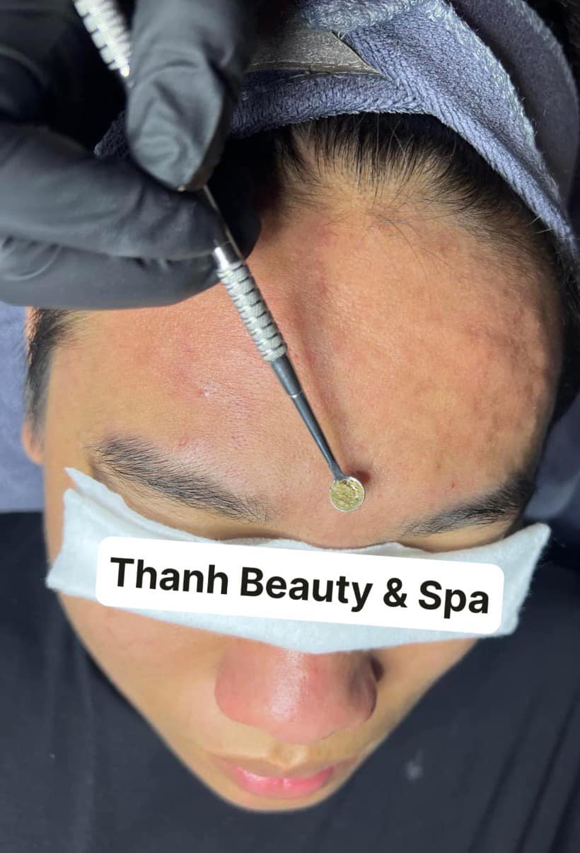Trải Nghiệm Công Nghệ Trị Liệu Da Đột Phá Với Celluma Tại Thanh Beauty & Spa!