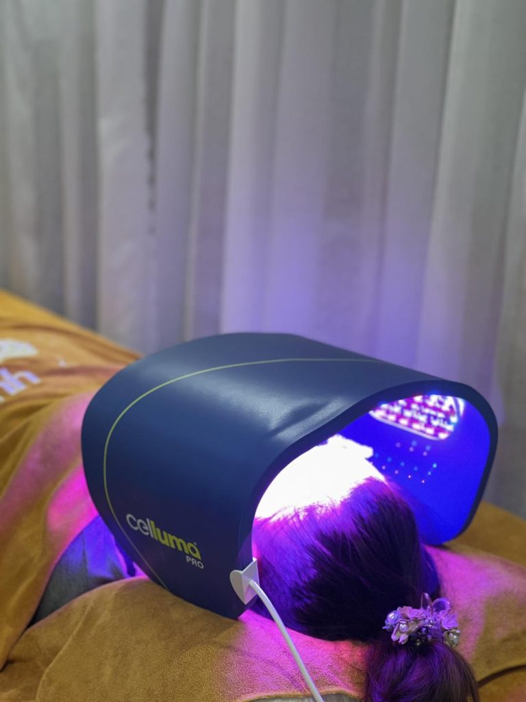 Trải Nghiệm Da Sáng Với Green Herbal Peel Tại Thanh Beauty & Spa